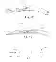 Fig. 40 - Straight intramedullary fracture fixation devices and methods