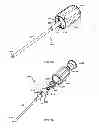 Fig. 47 - Straight intramedullary fracture fixation devices and methods