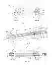 Fig. 48 - Straight intramedullary fracture fixation devices and methods