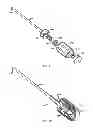 Fig. 49 - Straight intramedullary fracture fixation devices and methods