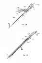 Fig. 64 - Straight intramedullary fracture fixation devices and methods