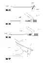 Fig. 82 - Straight intramedullary fracture fixation devices and methods