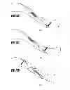 Fig. 83 - Straight intramedullary fracture fixation devices and methods