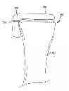 Fig. 01 - Arthroplasty devices and related methods