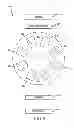 Fig. 09 - Arthroplasty devices and related methods