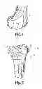 Fig. 02 - Devices and methods for performing knee arthroplasty