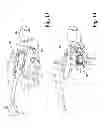 Fig. 08 - Devices and methods for performing knee arthroplasty