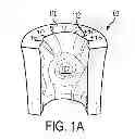 Fig. 03 - Patient-specific femoral version guide