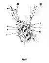 Fig. 06 - Method for locking an artificial facet between two vertebral bodies