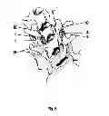 Fig. 07 - Method for locking an artificial facet between two vertebral bodies