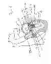 Fig. 02 - Transcatheter atrio-ventricular valve prosthesis