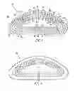 Fig. 02 - Breast implant with low coefficient of friction between internal shells in an aqueous fluid environment