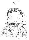 Fig. 07 - Slip-over light blocking sleep mask