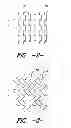 Fig. 03 - Stitch bonded cleaning material