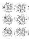 Fig. 09 - Vented metallic container end closure