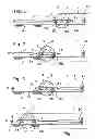 Fig. 02 - Method and apparatus for tensioning a cable