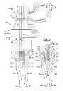 Fig. 02 - Adjustable laryngeal airway (ALA) device and method of use