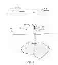 Fig. 02 - Thermal hydrate preventer