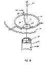 Fig. 08 - Beverage service rack