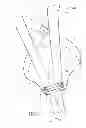 Fig. 06 - Strap lifter for use between two persons