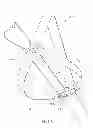 Fig. 07 - Strap lifter for use between two persons