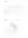 Fig. 02 - Motor vehicle body with expandable element