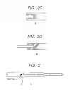 Fig. 03 - High pressure discharge lamp