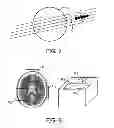 Fig. 06 - MRI method for retrospective motion correction with interleaved radial acquisition