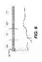 Fig. 07 - 3D intraoral measurements using optical multiline method