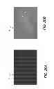 Fig. 22 - 3D intraoral measurements using optical multiline method