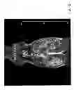 Fig. 09 - Polyol and polyether iron oxide complexes as pharmacological and/or MRI contrast agents