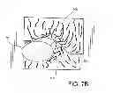 Fig. 08 - EXPANDABLE FLASHING MEMBRANE