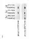 Fig. 02 - Methods of inhibiting photoreceptor apoptosis