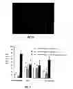 Fig. 06 - Modified starch material of biocompatible hemostasis