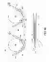 Fig. 22 - Analyte sensor