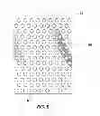 Fig. 07 - Tattoo removal system