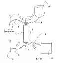 Fig. 09 - Device and method for preparing tissue, particularly adipose tissue