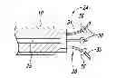 Fig. 01 - Method and apparatus for controlling narrowing of at least one airway