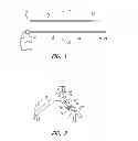Fig. 02 - Method and apparatus for controlling narrowing of at least one airway