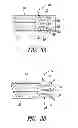Fig. 03 - Method and apparatus for controlling narrowing of at least one airway