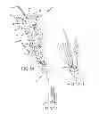 Fig. 02 - PEDICLE SUBTRACTION OSTEOTOMY DEVICE AND METHODS
