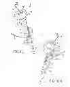 Fig. 07 - PEDICLE SUBTRACTION OSTEOTOMY DEVICE AND METHODS