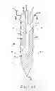 Fig. 08 - PEDICLE SUBTRACTION OSTEOTOMY DEVICE AND METHODS