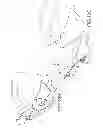Fig. 22 - PEDICLE SUBTRACTION OSTEOTOMY DEVICE AND METHODS