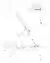 Fig. 07 - TRANSOSSEOUS ATTACHMENT INSTRUMENTS