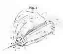 Fig. 02 - Percutaneous vein removal device