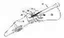Fig. 01 - ARTHRODESIS IMPLANT AND BUTTRESSING APPARATUS AND METHOD