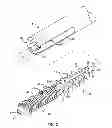 Fig. 03 - ARTHRODESIS IMPLANT AND BUTTRESSING APPARATUS AND METHOD