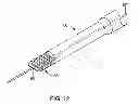 Fig. 08 - ARTHRODESIS IMPLANT AND BUTTRESSING APPARATUS AND METHOD