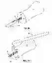 Fig. 16 - ARTHRODESIS IMPLANT AND BUTTRESSING APPARATUS AND METHOD